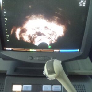 GE MEDICAL - IC5-9H