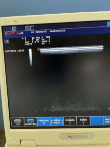 ESAOTE - LA435