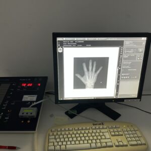 PROVOTEC - Digital Swivelarm X-ray device