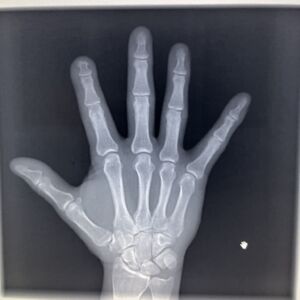 PROVOTEC - Digital Swivelarm X-ray device