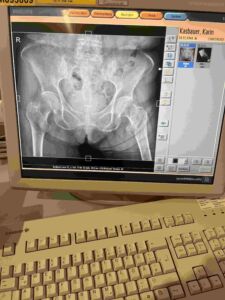 PHILIPS - x-ray diagnostic monitor