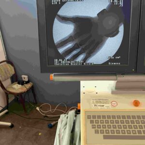 SIEMENS - Siremobil Iso 3D
