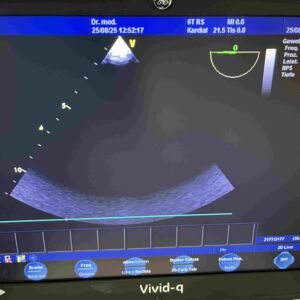 GE MEDICAL - TEE probe 6T-RS