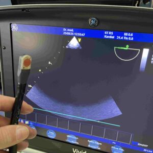 GE MEDICAL - TEE probe 6T-RS