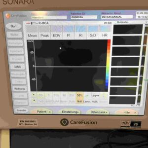 CAREFUSION - Sonara