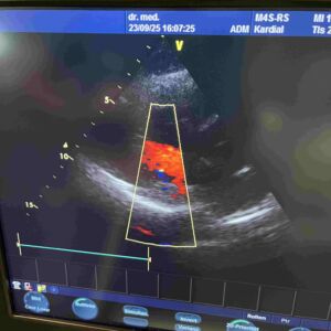 GE MEDICAL - Vivid S6