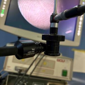 STORZ - Telecam 20210031 PAL