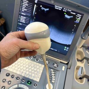 GE MEDICAL - Voluson I