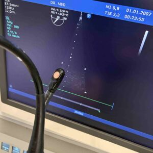PHILIPS - S7-2 Omni