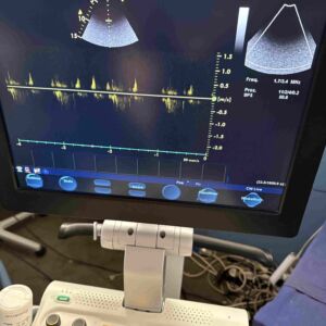 GE MEDICAL - Vivid S6